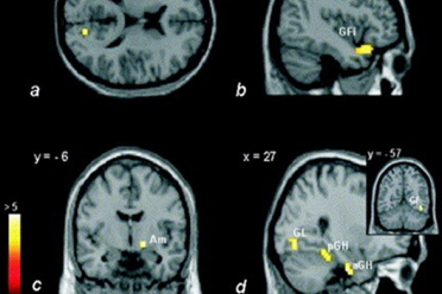 hipocamp